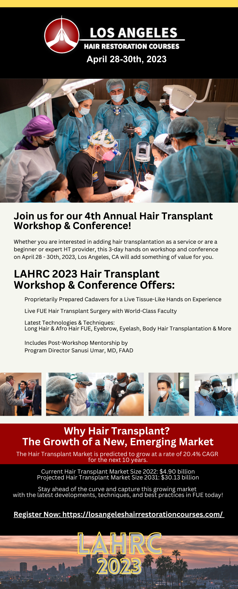 Los Angeles Hair Transplant Training | Advanced FUE For Beginners